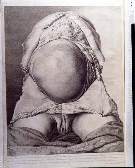 Anatomical drawing of the abdomen of a pregnant female human with skin peeled back from Jan van Rymsdyk