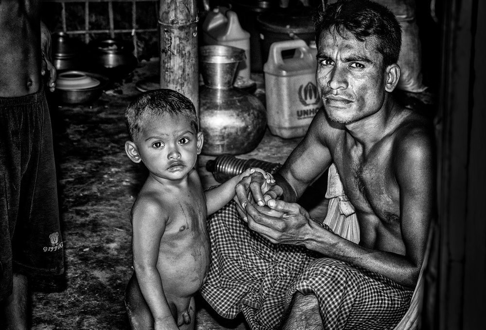 Rohingya refugee father and his son - Bangladesh from Joxe Inazio Kuesta Garmendia